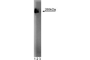 Western Blotting (WB) image for anti-Fatty Acid Synthase (FASN) (AA 9-202) antibody (ABIN968279) (Fatty Acid Synthase 抗体  (AA 9-202))