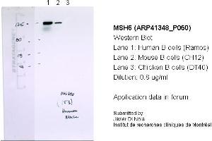 Western Blotting (WB) image for anti-MutS Homolog 6 (E. Coli) (MSH6) (N-Term) antibody (ABIN2776759) (MSH6 抗体  (N-Term))