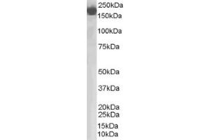 Image no. 1 for anti-Complement Factor H (CFH) (Internal Region) antibody (ABIN374588) (Complement Factor H 抗体  (Internal Region))