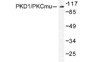 Image no. 1 for anti-Protein Kinase D1 (PRKD1) antibody (ABIN272067) (PKC mu 抗体)