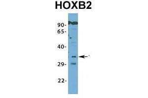 Western Blotting (WB) image for anti-Homeobox B2 (HOXB2) (N-Term) antibody (ABIN2776384)