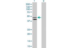 Western Blot analysis of HOMER1 expression in transfected 293T cell line by HOMER1 MaxPab polyclonal antibody. (HOMER1 抗体  (AA 1-354))