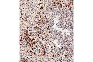 Immunohistochemistry (Paraffin-embedded Sections) (IHC (p)) image for anti-Nucleotide-Binding Oligomerization Domain Containing 1 (NOD1) (AA 923-951), (C-Term) antibody (ABIN655750)