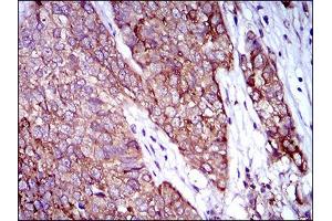 Western Blotting (WB) image for anti-Zinc Finger Protein 42 (ZFP42) (AA 249-310) antibody (ABIN1846770)