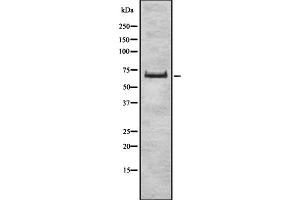 Western blot analysis of ZSCAN2 expression in HEK293 cells ,The lane on the left is treated with the antigen-specific peptide. (ZSCAN2 抗体  (Internal Region))