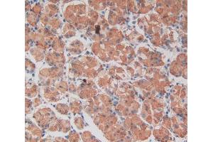 IHC-P analysis of stomach tissue, with DAB staining. (TEP1 抗体  (AA 2368-2627))