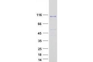 Western Blotting (WB) image for Breast Carcinoma Amplified Sequence 3 (BCAS3) (Transcript Variant 2) protein (Myc-DYKDDDDK Tag) (ABIN2715180)