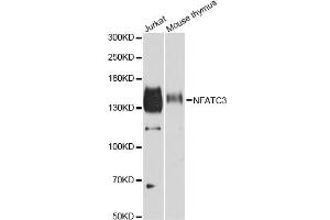 Western blot analysis of extracts of various cell lines, using NFATC3 antibody (ABIN2564121) at 1:500 dilution. (NFATC3 抗体)