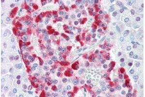 Human Pancreas (formalin-fixed, paraffin-embedded) stained with DFFA antibody ABIN461876 at 10 ug/ml followed by biotinylated goat anti-rabbit IgG secondary antibody ABIN481713, alkaline phosphatase-streptavidin and chromogen.