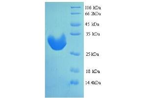 SDS-PAGE (SDS) image for Insulin-Like Growth Factor Binding Protein 1 (IGFBPI) (AA 26-272) protein (His tag) (ABIN5713538)