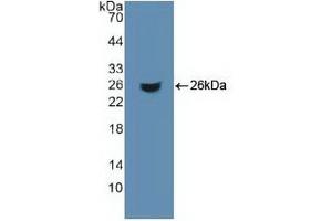 Western blot analysis of recombinant Human ACO1. (Aconitase 1 抗体  (AA 26-243))