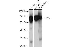 Western blot analysis of extracts of various cell lines, using PLVAP antibody (ABIN7269386) at 1:1000 dilution. (PLVAP 抗体  (AA 63-442))