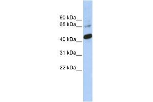 WB Suggested Anti-SOX1 Antibody Titration:  0. (SOX1 抗体  (Middle Region))