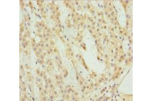 Immunohistochemistry of paraffin-embedded human adrenal gland tissue using ABIN7158523 at dilution of 1:100 (ACSL6 抗体  (AA 458-697))