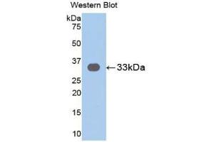 Detection of Recombinant IL31RA, Human using Polyclonal Antibody to Interleukin 31 Receptor A (IL31RA) (IL31RA 抗体  (AA 205-456))
