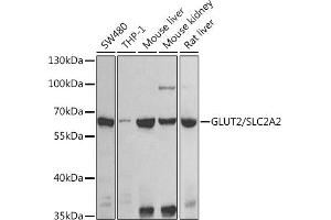 Western blot analysis of extracts of various cell lines, using GLUT2/GLUT2/SLC2 antibody (ABIN6134110, ABIN6147959, ABIN6147960 and ABIN6225170) at 1:1000 dilution. (SLC2A2 抗体  (AA 1-100))
