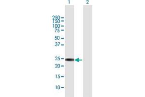 Western Blot analysis of KIF26A expression in transfected 293T cell line by KIF26A MaxPab polyclonal antibody. (KIF26A 抗体  (AA 1-203))