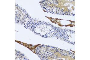 Immunohistochemistry of paraffin-embedded rat testis using FMOD antibody (ABIN2562633) at dilution of 1:100 (20x lens). (Fibromodulin 抗体)