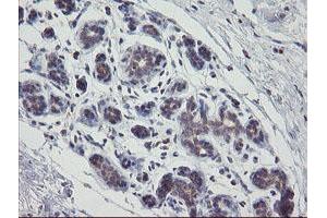 Immunohistochemical staining of paraffin-embedded Human breast tissue using anti-APP mouse monoclonal antibody. (APP 抗体)