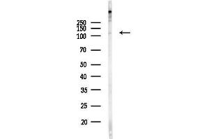 anti-Ubiquitin Specific Peptidase 11 (USP11) (Internal Region) antibody
