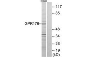 Western blot analysis of extracts from COLO205 cells, using GPR176 Antibody. (GPR176 抗体  (AA 466-515))