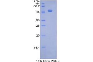 SDS-PAGE analysis of Mouse Pregnane X Receptor Protein. (NR1I2 蛋白)