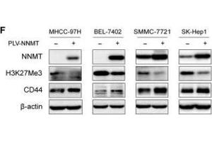 Western Blotting (WB) image for anti-Histone 3 (H3) (H3K27me) antibody (ABIN6219521)