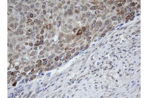 Image no. 1 for anti-Melanoma Antigen Family B, 1 (MAGEB1) antibody (ABIN1499265) (MAGEB1 抗体)