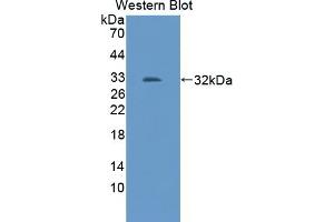 Detection of Recombinant TRAF2, Mouse using Polyclonal Antibody to TNF Receptor Associated Factor 2 (TRAF2) (TRAF2 抗体  (AA 238-491))