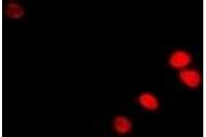 Immunofluorescent analysis of RAG-2 staining in U2OS cells. (RAG2 抗体)