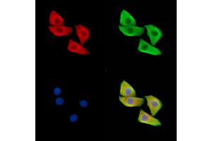 ABIN6265053 and ABIN6279817 staining Hela cells by IF/ICC.