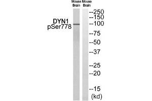 Western blot analysis of extracts from Mouse brain cells, using DYN1 (Phospho-Ser778) antibody. (Dynamin 1 抗体  (pSer778))