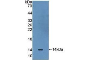 Detection of Recombinant IL10Ra, Human using Polyclonal Antibody to Interleukin 10 Receptor Alpha (IL10Ra) (IL-10RA 抗体  (AA 132-235))