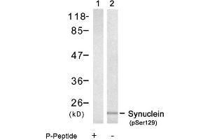 Image no. 1 for anti-Synuclein, alpha (SNCA) (pSer129) antibody (ABIN319236) (SNCA 抗体  (pSer129))