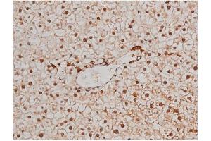 ABIN6267433 at 1/200 staining Rat liver tissue sections by IHC-P. (Filamin A 抗体  (pSer2152))