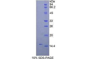SDS-PAGE analysis of Mouse Inhibin beta C Protein. (INHBC 蛋白)