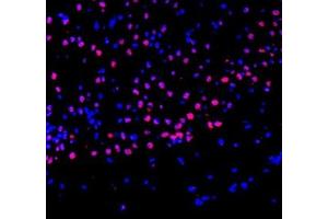 Immunofluorescence of paraffin embedded mouse brain using ZBTB40 (ABIN7076250) at dilution of 1:400 (300x lens) (ZBTB40 抗体)