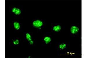 Immunofluorescence of purified MaxPab antibody to NOLC1 on HeLa cell. (NOLC1 抗体  (AA 1-700))