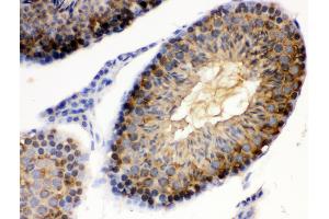 Immunohistochemistry (Paraffin-embedded Sections) (IHC (p)) image for anti-Heat Shock Protein 90kDa alpha (Cytosolic), Class A Member 1 (HSP90AA1) (AA 454-488), (C-Term) antibody (ABIN3043848) (HSP90AA1 抗体  (C-Term))