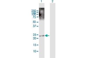 Western Blot analysis of TRIML1 expression in transfected 293T cell line by TRIML1 MaxPab polyclonal antibody. (TRIML1 抗体  (AA 1-192))