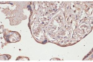 Immunohistochemistry of paraffin-embedded Human placenta using TXNRD1 Polyclonal Antibody at dilution of 1:100 (40x lens). (TXNRD1 抗体)