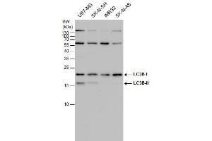 Western Blotting (WB) image for anti-Microtubule-Associated Protein 1 Light Chain 3 beta (MAP1LC3B) antibody (ABIN2854667)