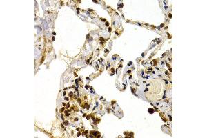 Immunohistochemistry of paraffin-embedded human normal lung using TFDP1 antibody at dilution of 1:200 (400x lens). (DP1 抗体)