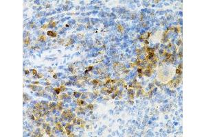 Immunohistochemistry (Paraffin-embedded Sections) (IHC (p)) image for anti-Sulfotransferase Family, Cytosolic, 2A, Dehydroepiandrosterone (DHEA)-Preferring, Member 1 (SULT2A1) antibody (ABIN7008595)