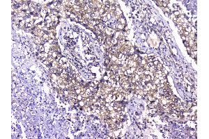 IHC analysis of TCP1 alpha using anti-TCP1 alpha antibody . (TCP1 alpha/CCTA 抗体  (C-Term))