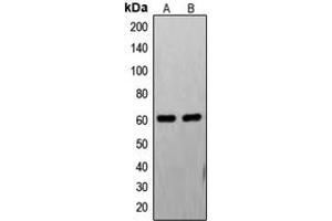 Western blot analysis of FAST Kinase expression in PC12 (A), HL60 (B) whole cell lysates. (FASTK 抗体  (Center))