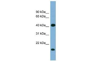 BXDC2 antibody used at 1 ug/ml to detect target protein. (BRIX1 抗体  (Middle Region))