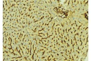 ABIN6276627 at 1/100 staining Mouse liver tissue by IHC-P. (AKR7A2 抗体  (Internal Region))