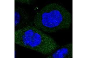 Immunofluorescent staining of human cell line A-431 with WIBG polyclonal antibody  at 1-4 ug/mL dilution shows positivity in cytoplasm. (PYM 抗体)