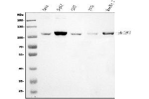 Western blot analysis of Epac1/RAPGEF3 using anti-Epac1/RAPGEF3 antibody (ABIN7601858).